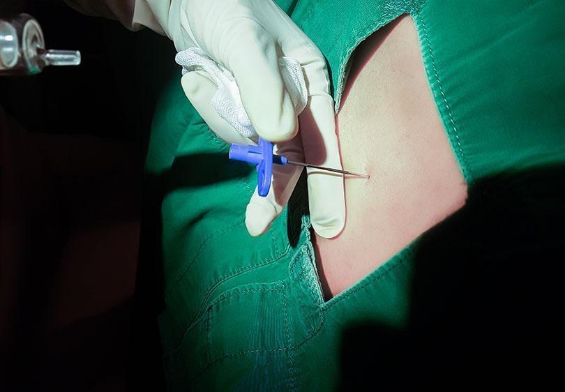 Fatal spinal surgery case