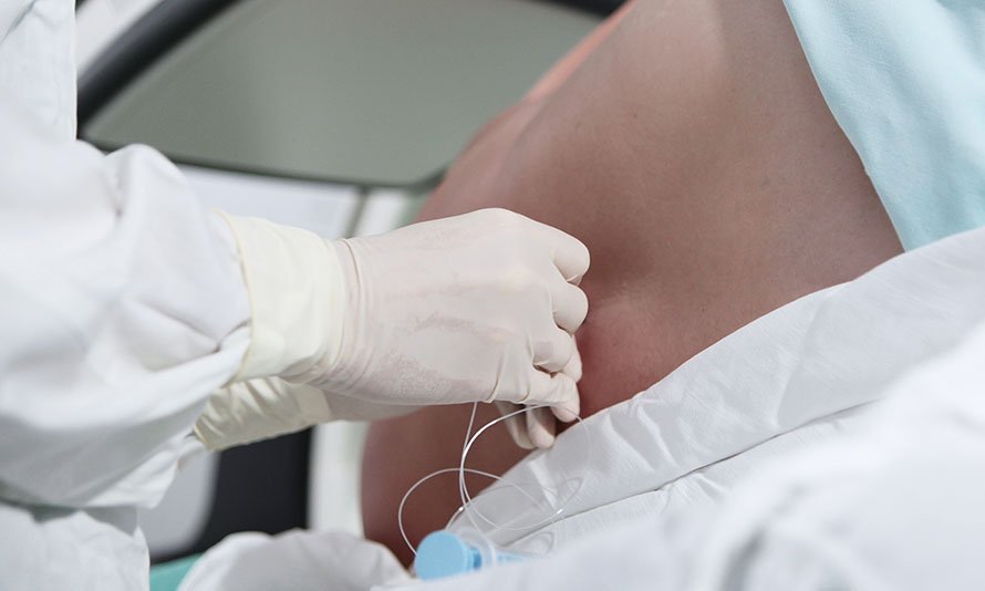 anesthesia erro medical malpractice nyc